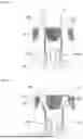 Fig. 10 - Electrode Lead Aligning and Masking Device