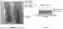 Fig. 02 - SENSOR FOR THEMAL PROPERTIES MEASUMENT USING THE 3 OMEGA METHOD AND METHODS OF USE THEREOF