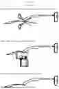 Fig. 18 - EYEWEAR RETENTION SYSTEM WITH CABLE SECURING MECHANISM