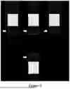 Fig. 06 - MASK OPTIMIZATION ACCOUNTING FOR MORE CRITICAL AND LESS CRITICAL OVERLAP REGIONS