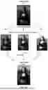 Fig. 02 - SYNTHETIC BRACKETING FOR EXPOSURE CORRECTION