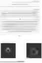Fig. 02 - GUIDEWIRE ARTIFACT SUPPRESSION METHOD AND DEVICE, IVUS SYSTEM, AND STORAGE MEDIUM
