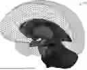 Fig. 01 - AUTOMATIC NEUROSURGICAL TARGET AND ENTRY POINT IDENTIFICATION