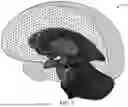 Fig. 02 - AUTOMATIC NEUROSURGICAL TARGET AND ENTRY POINT IDENTIFICATION