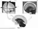 Fig. 03 - AUTOMATIC NEUROSURGICAL TARGET AND ENTRY POINT IDENTIFICATION