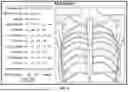 Fig. 06 - METHOD AND SYSTEM FOR QUANTIFICATION OF SEVERITY OF A LUNG DISEASE