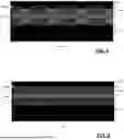 Fig. 04 - APPARATUS AND TUNING METHOD FOR MITIGATING RF LOAD IMPEDANCE VARIATIONS DUE TO PERIODIC DISTURBANCES