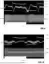 Fig. 07 - APPARATUS AND TUNING METHOD FOR MITIGATING RF LOAD IMPEDANCE VARIATIONS DUE TO PERIODIC DISTURBANCES