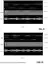 Fig. 11 - APPARATUS AND TUNING METHOD FOR MITIGATING RF LOAD IMPEDANCE VARIATIONS DUE TO PERIODIC DISTURBANCES