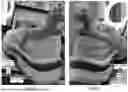 Fig. 03 - SPRING PLATE FOR ATHLETIC SHOE MIDSOLE