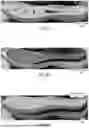 Fig. 04 - SPRING PLATE FOR ATHLETIC SHOE MIDSOLE
