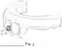Fig. 02 - METHODS OF DESIGNING DENTAL ATTACHMENT FORMATION APPARATUSES