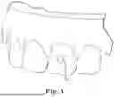 Fig. 06 - METHODS OF DESIGNING DENTAL ATTACHMENT FORMATION APPARATUSES