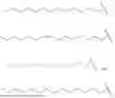 Fig. 52 - ANTIBACTERIAL CYCLOPEPTIDES TARGETING ACINETOBACTER AND OTHER GRAM-NEGATIVE PATHOGENS