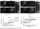 Fig. 07 - GENERATION OF NEURAL ORGANIZER ORGANOIDS AND MIDLINE ASSEMBLOIDS FROM HUMAN PLURIPOTENT STEM CELLS