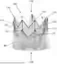 Fig. 01 - HEART VALVE THAT INCLUDES COATING MATERIAL