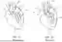 Fig. 03 - HEART VALVE THAT INCLUDES COATING MATERIAL