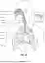 Fig. 06 - GAS WASHOUT VENT FOR PATIENT INTERFACE
