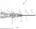 Fig. 02 - Intravenous Access Device For Administering Intravenous Fluid