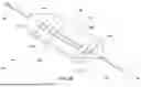 Fig. 05 - BALLOON CATHETER METHODS OF USE
