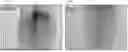 Fig. 09 - SWALLOWABLE, SELF-EXPANDABLE DRUG DELIVERY DEVICE AND USES THEREOF