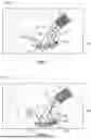 Fig. 06 - HEMOSTASIS AND FLUSHING METHOD AND APPARATUS FOR TRANS-CATHETER ANNULOPLASTY