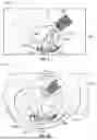Fig. 07 - HEMOSTASIS AND FLUSHING METHOD AND APPARATUS FOR TRANS-CATHETER ANNULOPLASTY