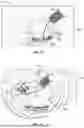 Fig. 08 - HEMOSTASIS AND FLUSHING METHOD AND APPARATUS FOR TRANS-CATHETER ANNULOPLASTY