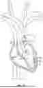Fig. 02 - GUIDEWIRE
