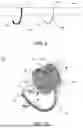 Fig. 06 - ANCHOR SYSTEM FOR RETAINING A DEVICE IN TISSUE