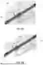 Fig. 08 - ANCHOR SYSTEM FOR RETAINING A DEVICE IN TISSUE