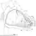 Fig. 02 - DELIVERY DEVICES AND METHODS FOR LEADLESS CARDIAC DEVICES