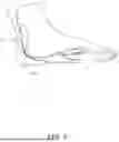 Fig. 06 - ANKLE CUFF FOR MANAGING INCONTINENCE