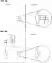 Fig. 04 - NEUROMODULATION DEVICE