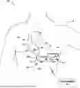 Fig. 01 - SYSTEMS AND METHODS FOR LEADLESS PACING AND SHOCK THERAPY