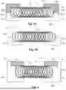 Fig. 06 - COILED RING CONTACTS FOR ELECTRICAL STIMULATION SYSTEMS AND METHODS OF MAKING AND USING SAME