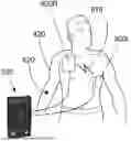 Fig. 01 - Method of using a medical device