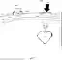 Fig. 06 - MOBILE DEFIBRILLATOR WITH IMPROVED PADS, CHARGING, AND SWITCHING