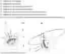 Fig. 01 - MAGNETICALLY-ASSISTED DELIVERY INTO AND THROUGH THE SKIN