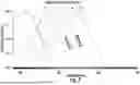 Fig. 08 - Ocular Photo-Bio-Stimulation Optics