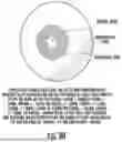 Fig. 41 - Ocular Photo-Bio-Stimulation Optics