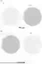 Fig. 05 - APPARATUSES AND SYSTEMS FOR PANCHARATNAM-BERRY PHASE AUGMENTED GRADIENT-INDEX LIQUID CRYSTAL LENSES