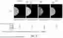Fig. 07 - Non-Uniform Thickness Breast Imaging Phantom for 2D/3D Spectral Imaging