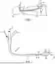 Fig. 02 - COAPTATION ULTRASOUND DEVICES AND METHODS OF USE