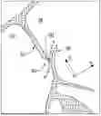 Fig. 01 - METHODS AND DEVICE FOR CLOSURE OF A TISSUE DEFECT