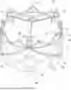 Fig. 01 - PROSTHETIC VALVE