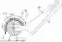 Fig. 01 - ACETABULAR CUP AND HIP JOINT PROSTHESIS ASSEMBLY
