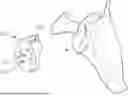 Fig. 01 - GUIDES AND INSTRUMENTS FOR IMPROVING ACCURACY OF GLENOID IMPLANT PLACEMENT