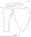 Fig. 02 - GUIDES AND INSTRUMENTS FOR IMPROVING ACCURACY OF GLENOID IMPLANT PLACEMENT