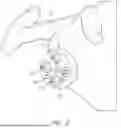 Fig. 03 - GUIDES AND INSTRUMENTS FOR IMPROVING ACCURACY OF GLENOID IMPLANT PLACEMENT
